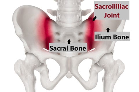 Pelvic Joint Pain